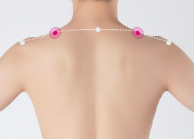 ����@���񂹂��@�c�{�@������⌨�̒ɂ݁A��J�񕜂Ɍ���